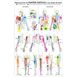Puntos Gatillo - Lámina Anatomía