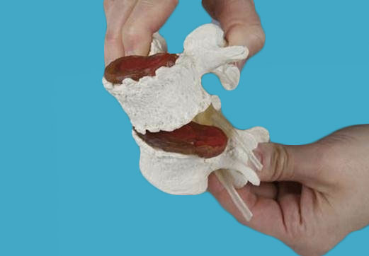 Modelo degeneración vertebral desmontable y flexible